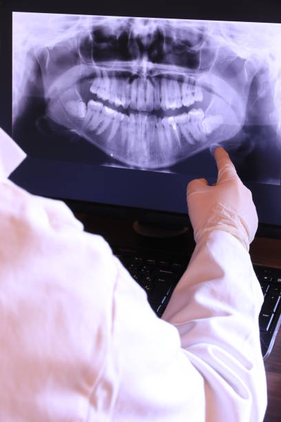 Best Emergency Dental Care for Broken or Chipped Teeth in Lifornia City, CA